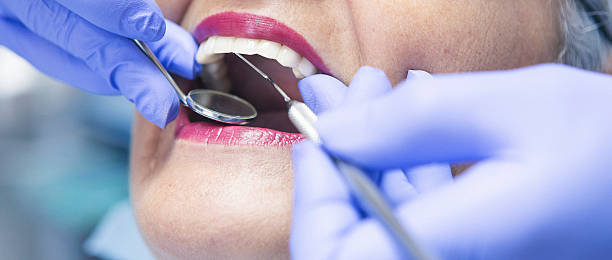 Best Emergency Tooth Extraction in USA